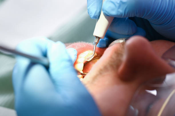 Best Cosmetic Emergency Dentistry in Deale, MD