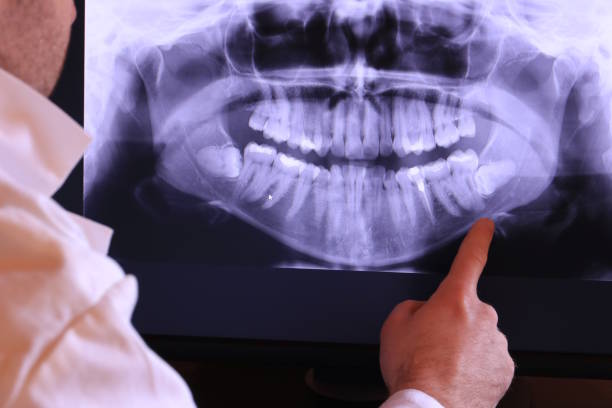 Best Pediatric Emergency Dentist in Deale, MD
